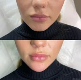 Студия косметологии и лазерной эпиляции Beauty Face Lab фото 4