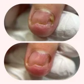 Центр сложного педикюра и восстановления ногтей и кожи Rosilak фото 6