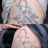 Клиника удаления татуировок и татуажа бровей Мити Цедермана фото 1